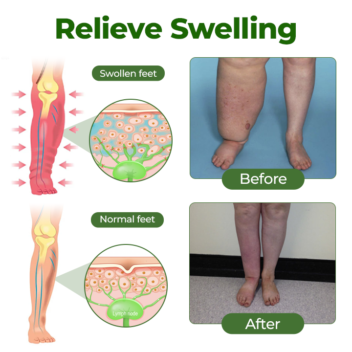 Professional Leg Circulation Cream -