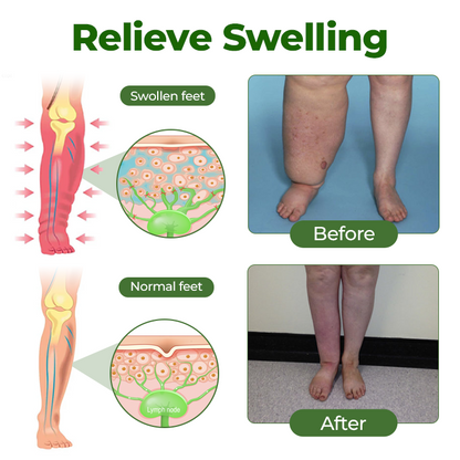 Professional Leg Circulation Cream -