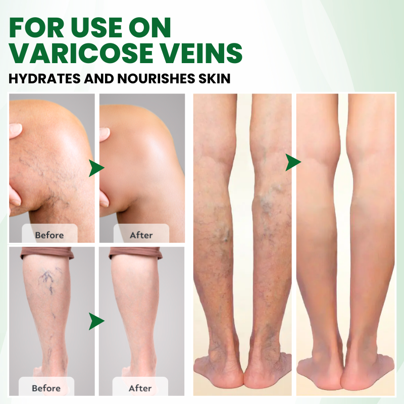 VariPoint™ Phyto-Vascular Microneedle Patch