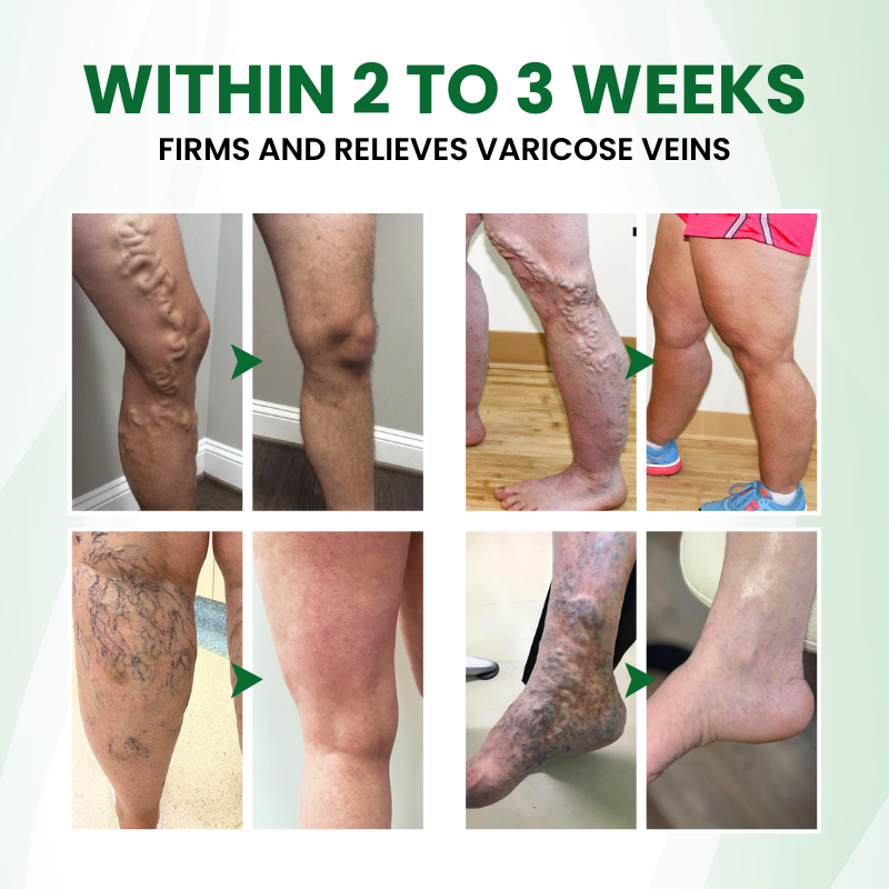 VariPoint™ Phyto-Vascular Microneedle Patch