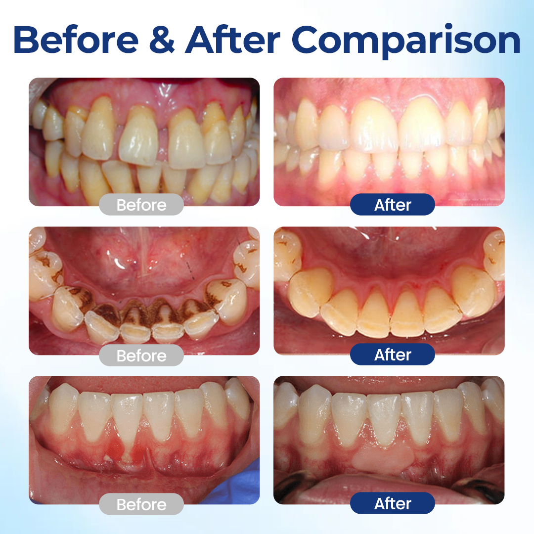 BeeTakt Oral Repair Solution.
