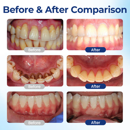 BeeTakt Oral Repair Solution.
