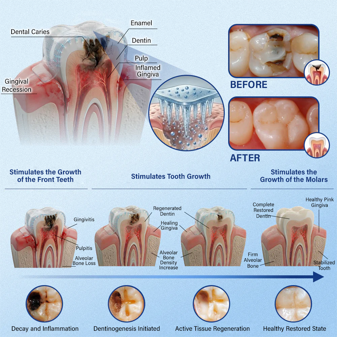 Tooth & Gum Care Fast-Dissolving Microneedle Patch -
