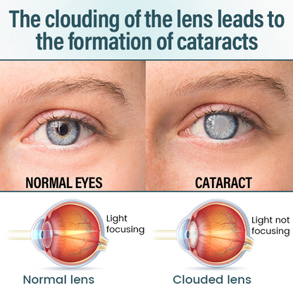 OptiFusion Nano Eye Drops Serum —Nano Technology Restores Clear Vision,  No Glasses, No Surgery