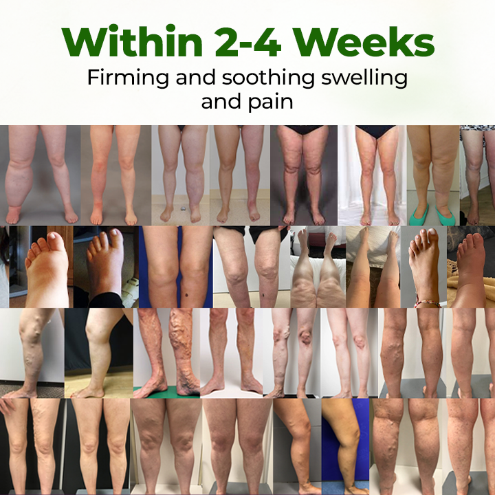 Professional Leg Circulation Cream -